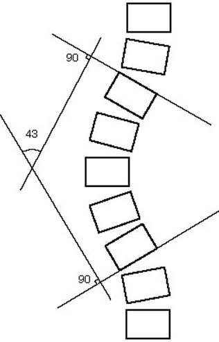 Cobb's angle (*) measurement in scoliosis. (A) Before application of