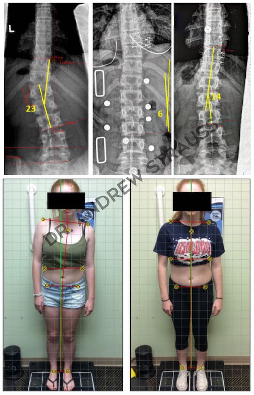 Dr. Andrew Strauss Before & After 3