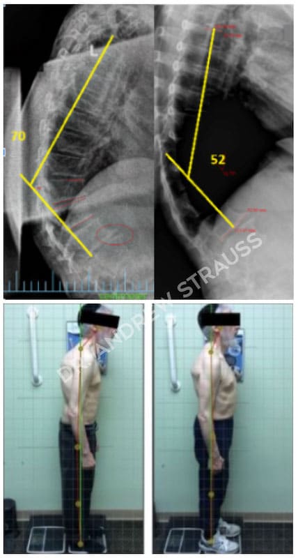 Dr. Andrew Strauss Before & After 5