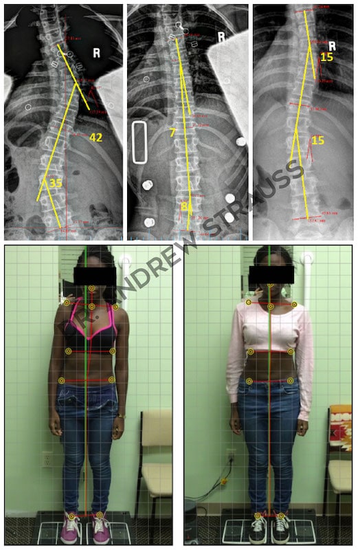 Dr. Andrew Strauss Before & After 7