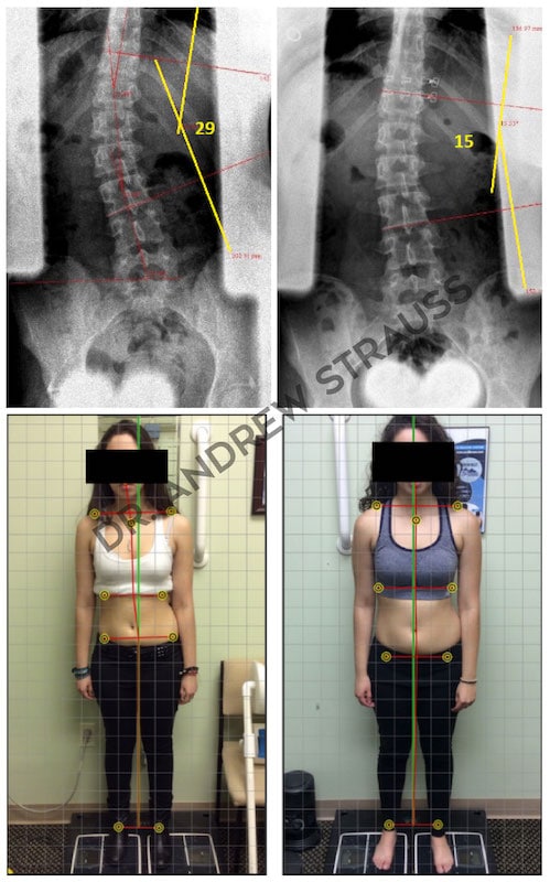 Dr. Andrew Strauss Before & After 8