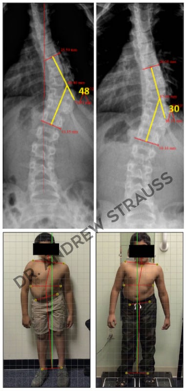 Dr. Andrew Strauss Before & After 9