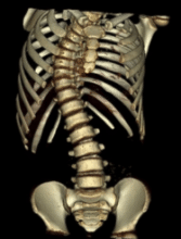 3-D rendering of upper torso bones