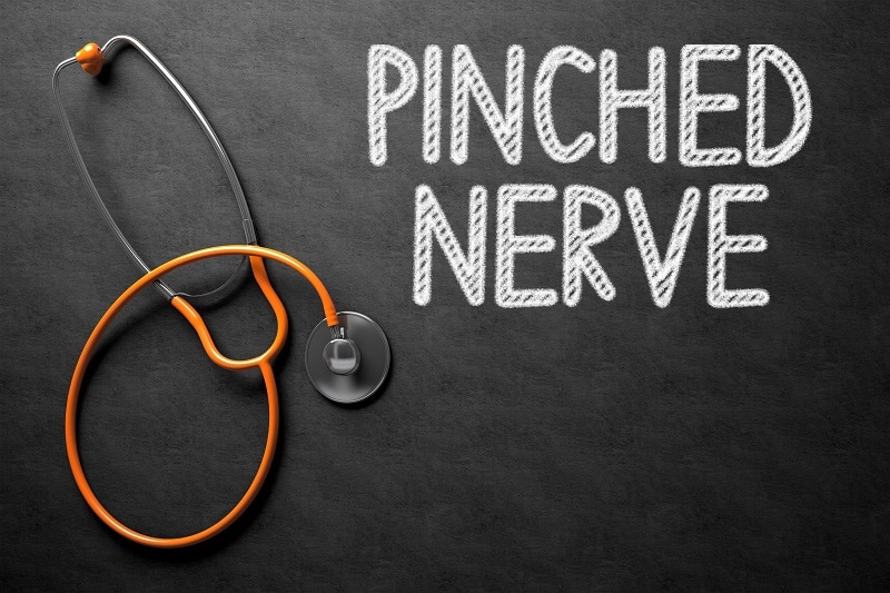 Pinched Nerve