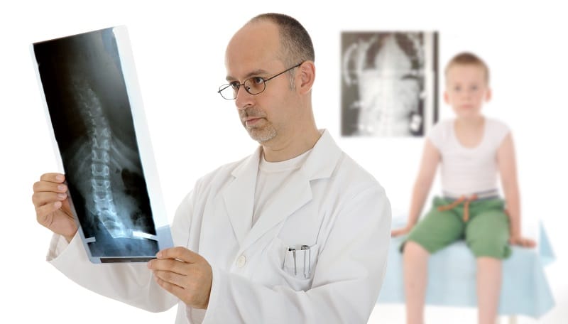 Scoliosis X-Rays Determine Treatment Approach.