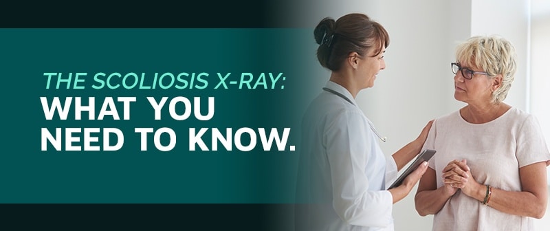 The Scoliosis X-Ray: What You Need to Know Image
