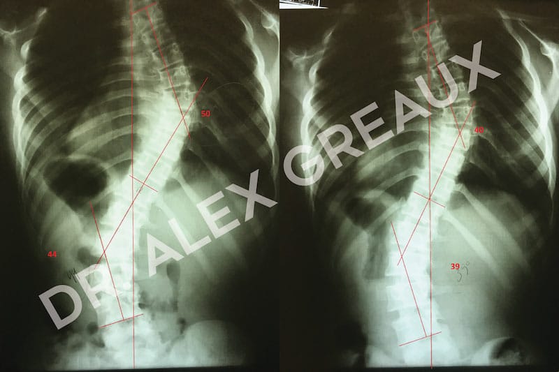 Dr. Alexander Greaux Before & After 1
