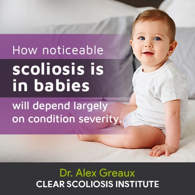 how noticable scoliosis is in babies