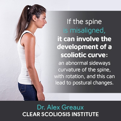 If the spine is misaligned, it can involve the development of a scoliotic curve: an abnormal sideways curvature of the spine, with rotation, and this can lead to postural changes.
