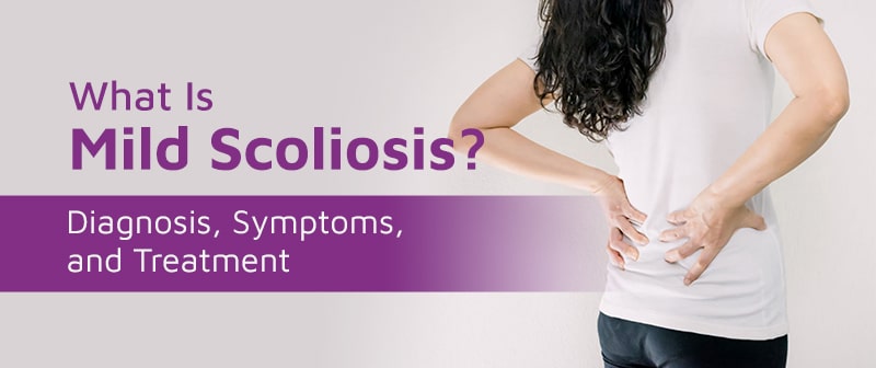 What Is Mild Scoliosis? Diagnosis, Symptoms, and Treatment Image