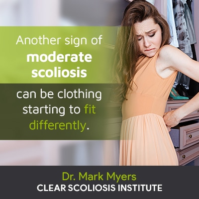 Another sign of moderate scoliosis can be clothing starting to fit differently.