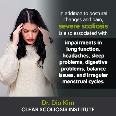 "In addition to postural changes and pain, severe scoliosis is also associated with impairments in lung function, headaches, sleep problems, digestive problems, balance issues, and irregular menstrual cycles."