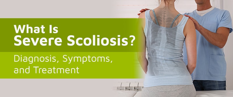 What Is Severe Scoliosis? Diagnosis, Symptoms, and Treatment Image
