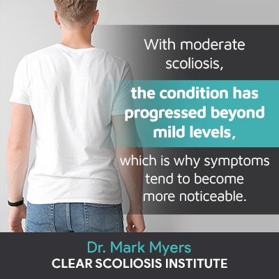 With moderate scoliosis, the condition has progressed beyond mild levels, which is why symptoms tend to become more noticeable.