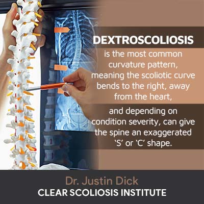 dextroscoliosis-is-the-most-common
