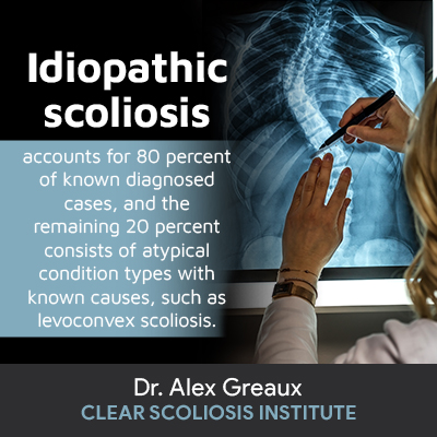 idiopathic-scoliosis-accounts-for