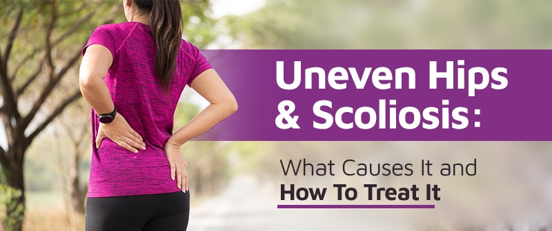 Uneven Hips & Scoliosis: What Causes It and How To Treat It Image