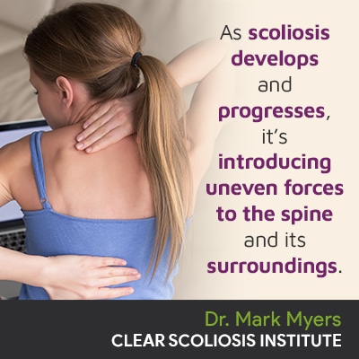 as-scoliosis-develops-and