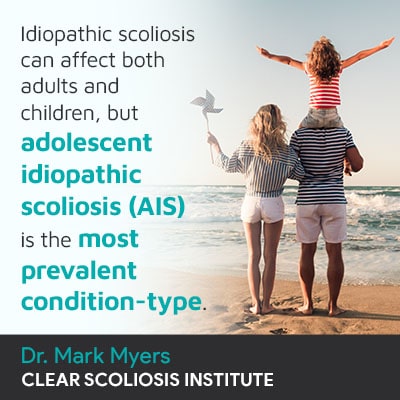 idiopathic-scoliosis-can-affect-both