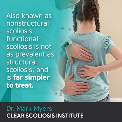 Also known as nonstructural scoliosis.