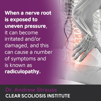 When a nerve root is