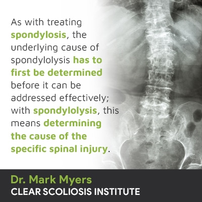 As with treating spondylosis