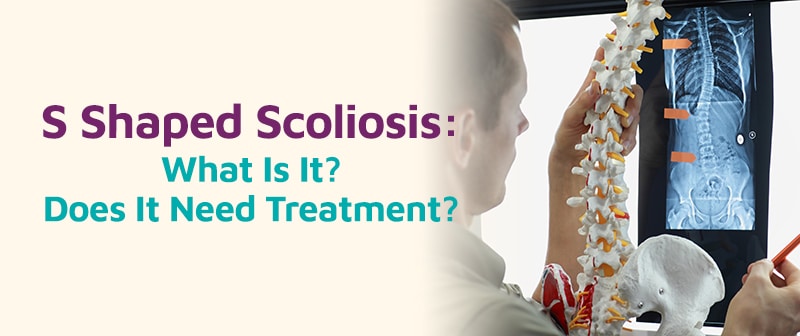 S-Shaped Scoliosis: What Is It? Does It Need Treatment? Image