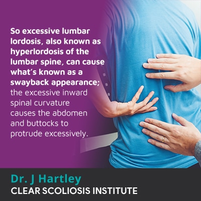 so excessive lumbar lordosis