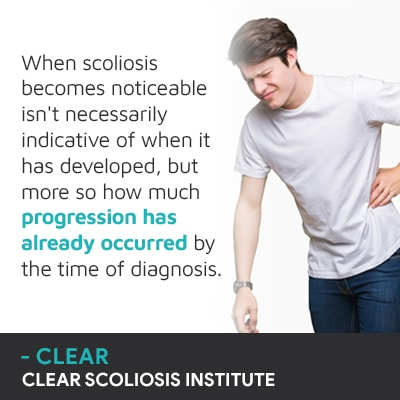 when scoliosis becomes noticeable