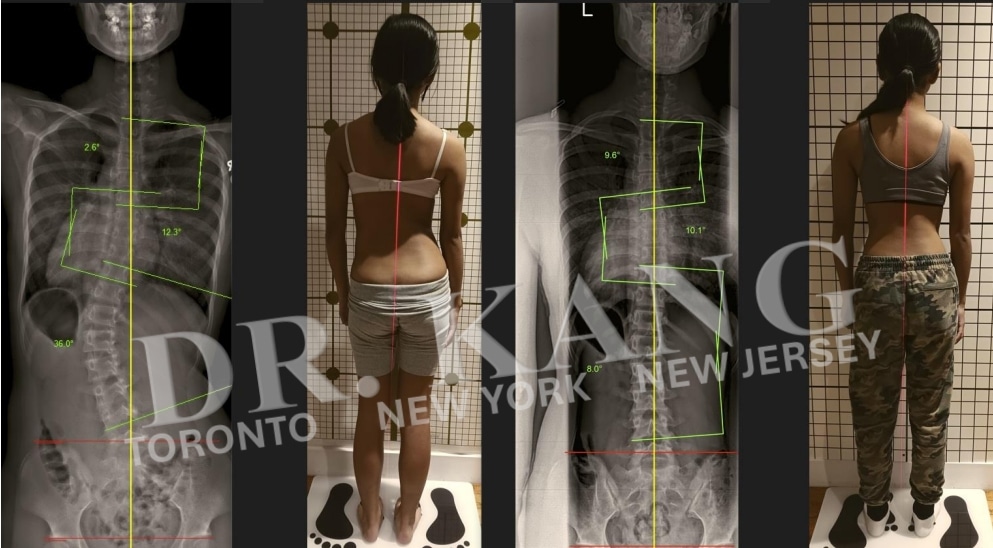 Dr. Jacob Kang Before & After 4