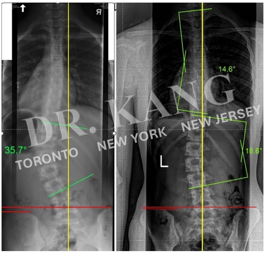 Dr. Jacob Kang Before & After 5