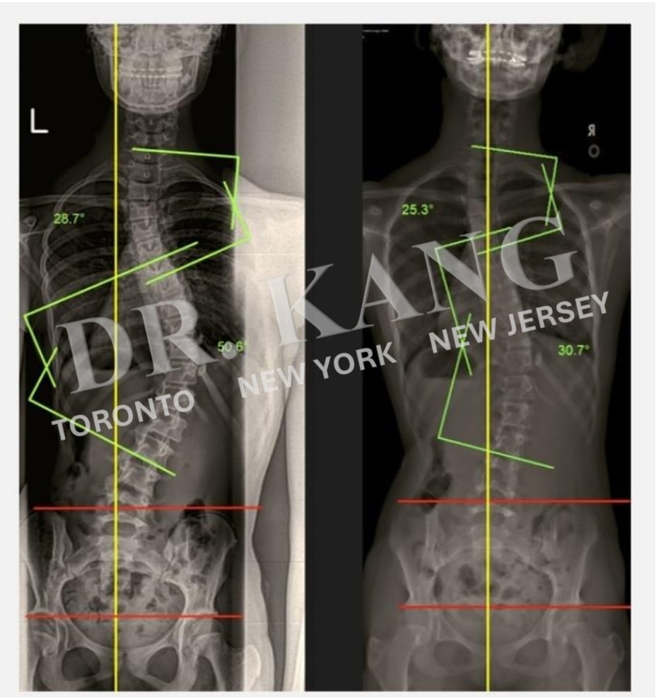 Dr. Jacob Kang Before & After 6