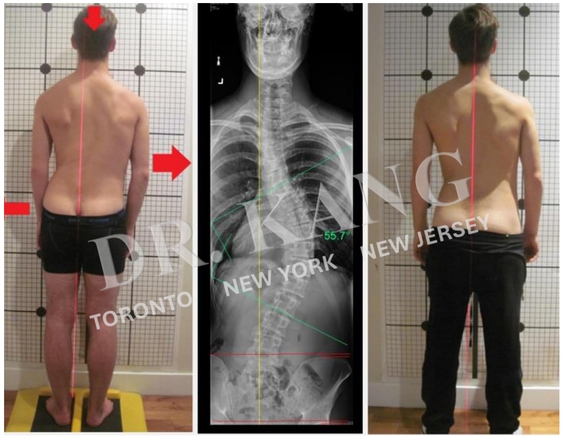 Dr. Jacob Kang Before & After 7