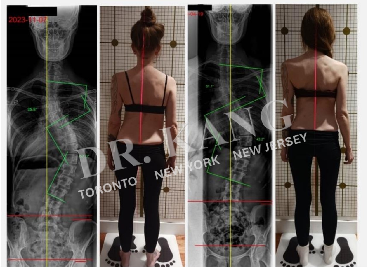 Dr. Jacob Kang Before & After 8