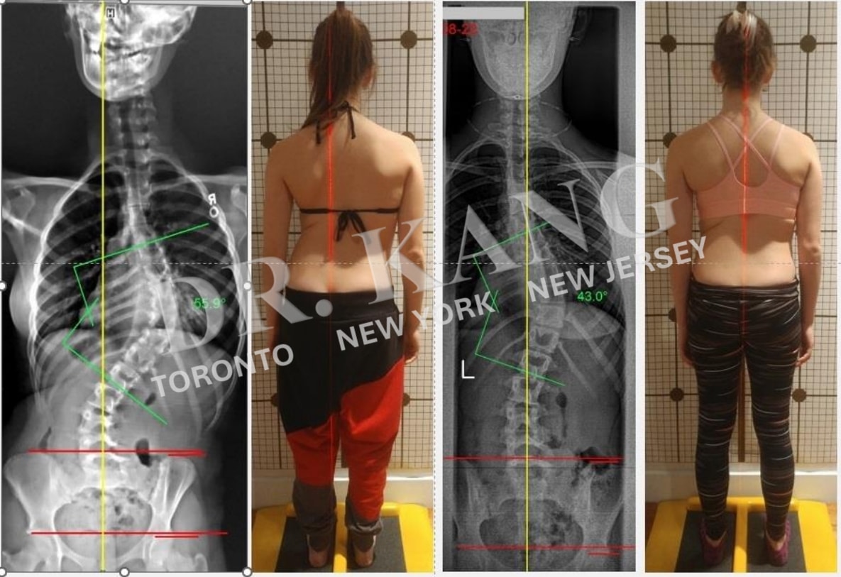 Dr. Jacob Kang Before & After 9