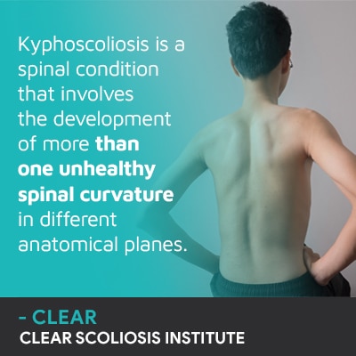 kyphoscoliosis is a spinal condition