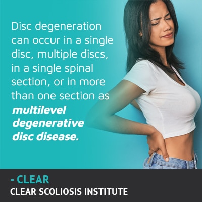 disc degeneration can occur