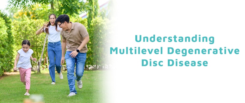 Understanding Multilevel Degenerative Disc Disease Image