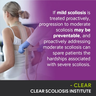 If mild scoliosis is treated