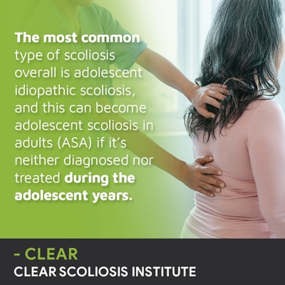 A visual representation of the quote from the text starting with “the most common type of scoliosis"