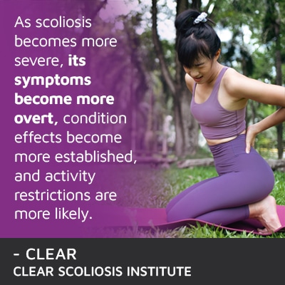 A visual representation of the quote from the text starting with “As scoliosis becomes more severe"