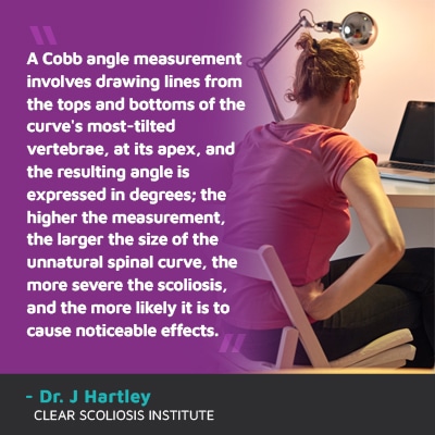 A visual representation of the quote from the text starting with “A Cobb angle measurement involves"