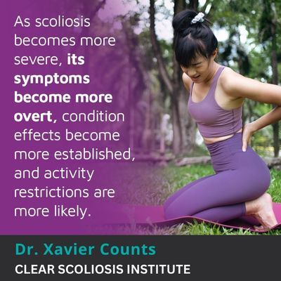 A visual representation of the quote from the text starting with “As scoliosis becomes more severe"
