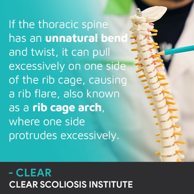 A visual representation of the quote from the text starting with “If the thoracic spine has"