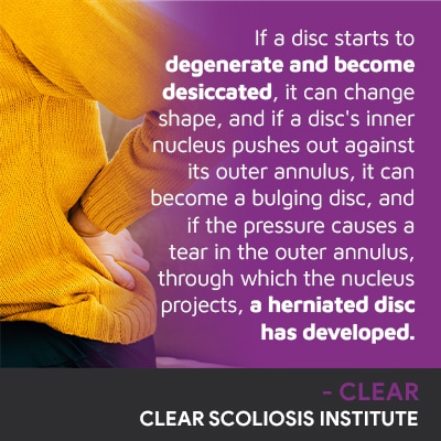 A visual representation of the quote from the text starting with “If a disc starts to degenerate and become"