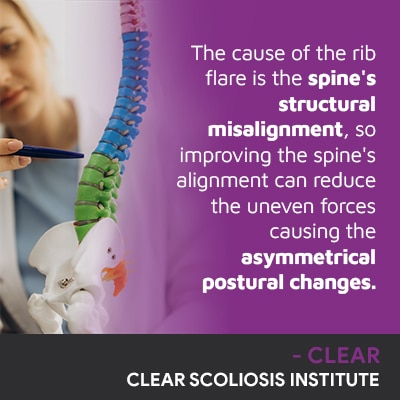 A visual representation of the quote from the text starting with “The cause of the rib flare"