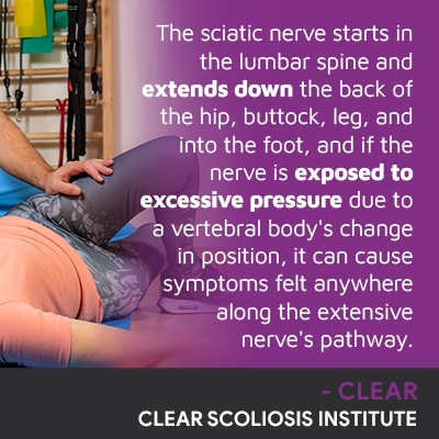 A visual representation of the quote from the text starting with “The sciatic nerve starts in the lumbar"