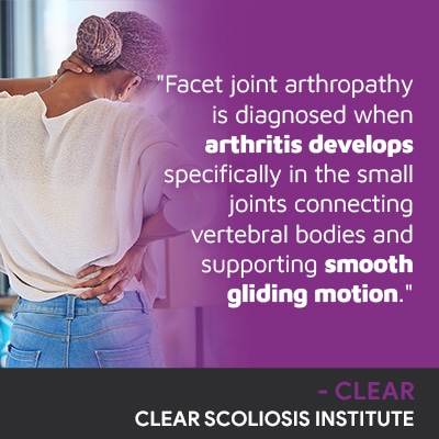 A visual representation of the quote from the text starting with “Facet Joint arthropathy is diagnosed"
