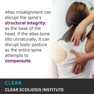 A visual representation of the quote from the text starting with “Atlas misalignment can disrupt the"